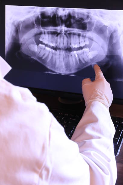 Best Emergency Dental Services for Seniors in Diamond Springs, CA