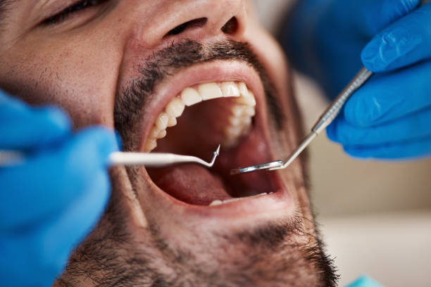 Best Mobile Emergency Dentist in Diamond Springs, CA