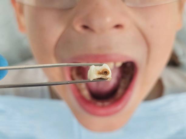 Best Urgent Dental Care for Toothache in Diamond Springs, CA