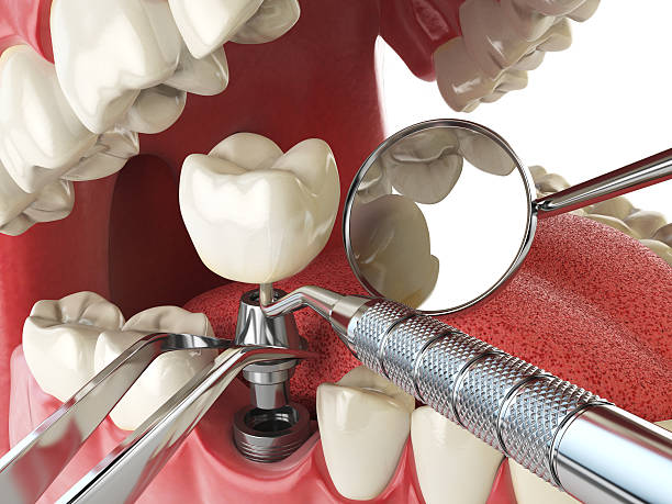 Best Emergency Dentist for Special Needs Patients in Diamond Springs, CA